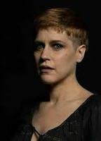 Рана Рзонскински