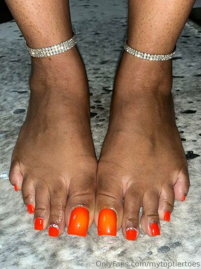 Mytoptiertoes