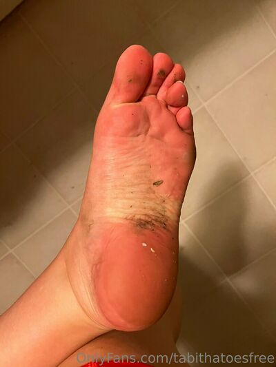 Tabithatoesfree