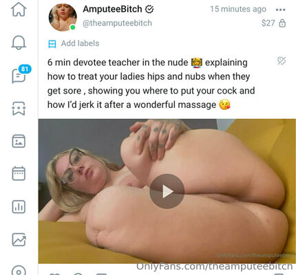 Theamputeebitch