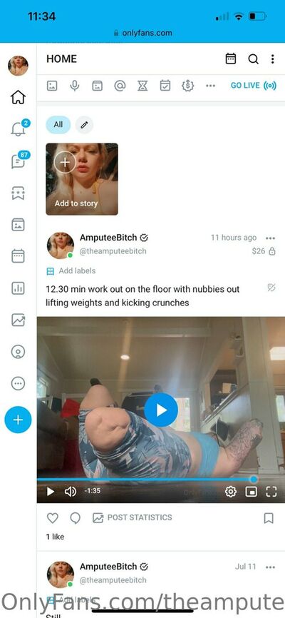 Theamputeebitch