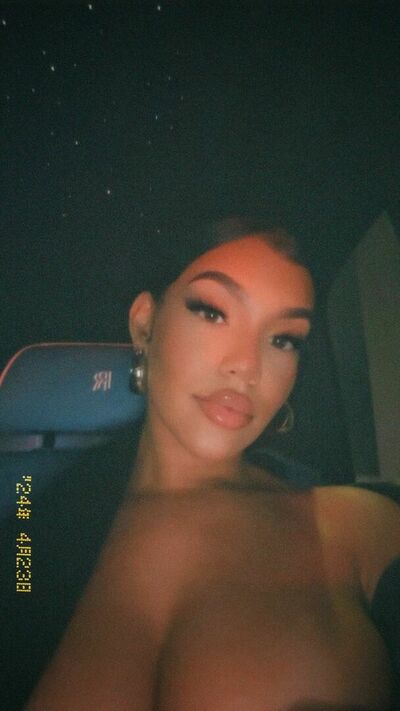 Xttiona