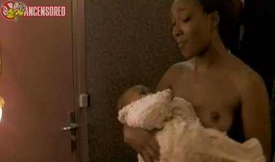 Надюша Боссон-диагн